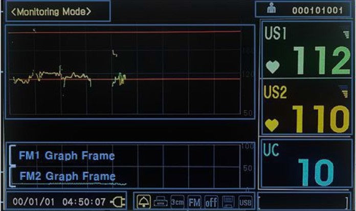 Medical Econet ECOtwin LCD Fetalmonitor