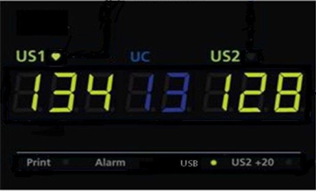 ECOtwin LED Fetalmonitor für Zwillinge, 7″ Segment-LED