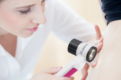 Dermatoskop LuxaScope LED 2.5 V mit Skala